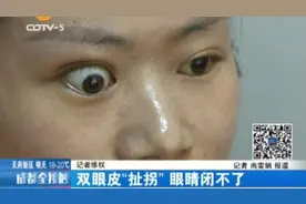 做个双眼皮手术 结果让人不敢直视图片