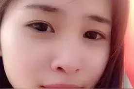 上唇肥厚的女性注意了图片