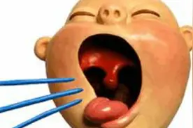 宝宝发出“呼噜噜”的声音是生病了？NO！它也可能是生理病态！图片