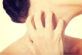 为什么跑步有时候身上会痒？图片