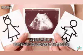 B超上的图片让你知道是男宝宝还是女宝宝
