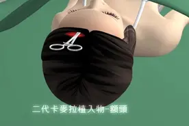 【3D动画】额头手术全程！视频封面