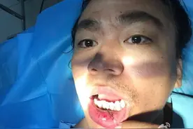 王宝强晒受伤照片 伤口缝了十针满脸痛苦 网友:这不是王祖蓝？图片