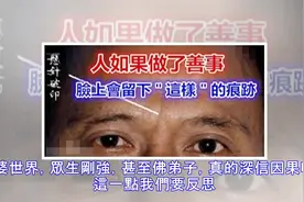 人做了善事，積了陰德，都會臉上留下痕跡.....视频封面