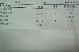 乙肝两对半检查结果是25阳性说明什么图片