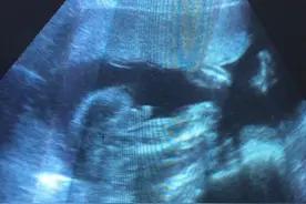 成功女翻男，4个月时说是女,今天确认是男宝!说说我的症状吧!图片