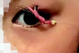 杭州小姑娘昨夜被紧急送医 钱塘江边这事儿真该管管了图片