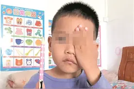 玩耍中被同伴铅笔射中图片