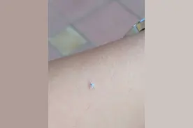 总有小飞虫扑面而来，专家：可能是蚜虫或粉虱，对人基本无害图片