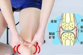 骨膜炎中医治疗方法 治疗骨膜炎的有效治疗方法 滑膜炎注意什么图片