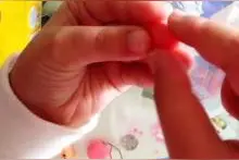 撕皮上瘾也是心病，得治！图片