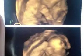 孕期很多症状都是女宝的，但四维通过医生透露却这样说图片