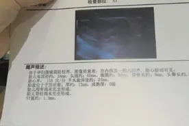 促排过程中卵巢破裂 知道真相后我崩溃了图片