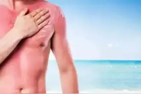 脸上莫名红肿溃烂，竟然只是因为吃完这些忘了一件事！图片