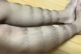 太逗逼了：男把腿毛剃成像「雨伞节」，给你87分，不能再多了！图片