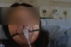 西安22岁女孩拔智齿后昏倒 重度感染危及生命图片