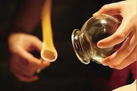 拔罐调理肾虚腰痛图片