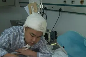 8岁四川男孩掉进澡堂加热池全身70%被烫伤 父亲割掉半个头皮救子图片