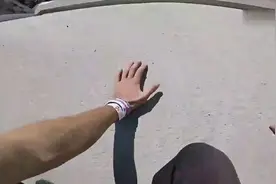 这点小伤算什么？为了作死一切皆可抛！