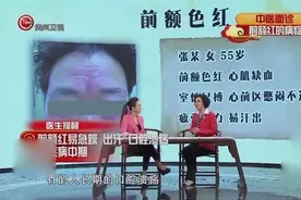 看脸就能知道身体健康状况，前额红预示着五脏哪里出问题你知道吗视频封面