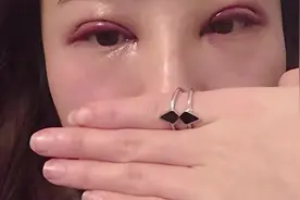 瞒着家人做了双眼皮手术 恢复后父母都夸好看 朋友都心动了