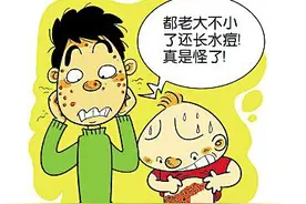 起“水痘”差点毁容 成人患“水痘”千万不要大意图片