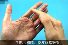 手粗糙脱皮无光泽怎么办？简单实用的方法让你拥有一副光滑的手视频封面