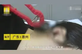 女子上树摘荔枝时不慎摔下 手里的剪刀刺进右耳图片