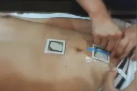 脾胃虚寒怎么办？3分钟手把手教你脾胃三伏贴，在家就能做视频封面