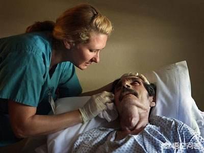 控制肿瘤，带瘤生存是一个系统工程，仅靠治疗还不行，需注意这些