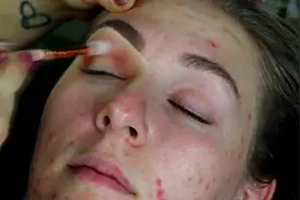 大姐满脸是痘痘，半边脸化妆对比一下，堪比换脸