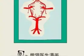 兄弟，你的脑血管有侧支循环吗？图片