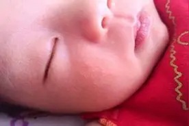 宝宝长小红疙瘩怎么办图片