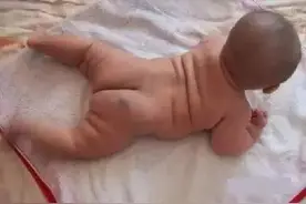 这里有胎记，注定富贵一生，衣食无忧！图片
