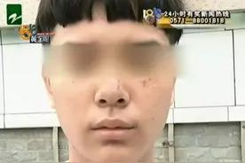杭州小伙球场打篮球 被广场舞大妈抓成大花脸图片