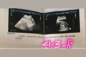 四维归来开扒男宝症状！胎动起来完全就是拳打脚踢图片