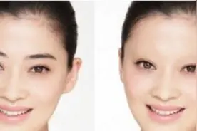 眉毛浓稀不仅影响容貌也影响着个人运势，看看眉毛稀疏运势图片