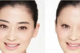 眉毛浓稀不仅影响容貌也影响着个人运势，看看眉毛稀疏运势图片