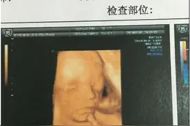 怀孕七个月只想吃肉和酸的 最后意外得了男宝图片