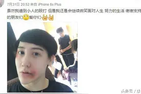 刘梓晨被打后又直播，网友：把你发射到里约给霍顿图片