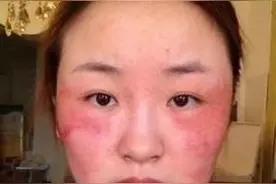 你用的化妆品有激素吗？赶紧来看看！图片