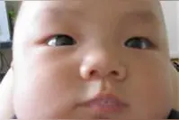 孩子口吐白沫？不要方，及时护理才是王道图片