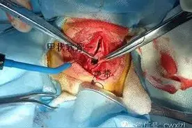 狗狗在家一直叫被投诉了，房东居然建议我带狗做声带切除手术图片