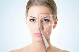 去痘印的小方法，轻松简单又省钱，用过的都说很不错图片