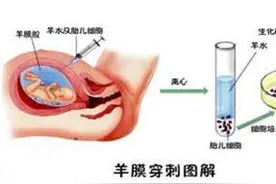 NT增厚4.3mm顺利过关 5点经验总结奉献给孕妈咪们！图片