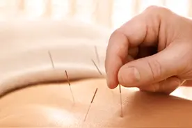 腰椎间盘突出症的针灸治疗图片