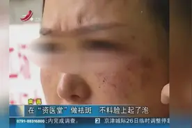 祛斑变“毁容” 脸上起了泡 医生：属于烧伤类视频封面