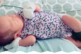 半月大宝宝指头坏死致截肢，罪魁祸首竟然是它图片