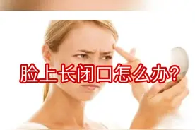 #护肤保养# 闭口不要急于清理，要分清闭合型粉刺和黑头型粉刺视频封面