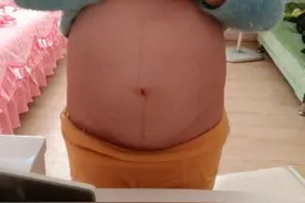 看看我的怀孕照和症状，结果很多宝妈都猜错了图片